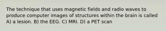 The technique that uses magnetic fields and radio waves to produce computer images of structures within the brain is called A) a lesion. B) the EEG. C) MRI. D) a PET scan