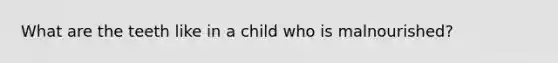 What are the teeth like in a child who is malnourished?