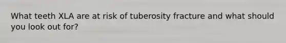 What teeth XLA are at risk of tuberosity fracture and what should you look out for?