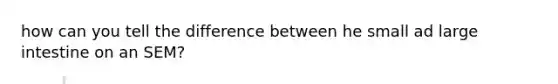 how can you tell the difference between he small ad <a href='https://www.questionai.com/knowledge/kGQjby07OK-large-intestine' class='anchor-knowledge'>large intestine</a> on an SEM?