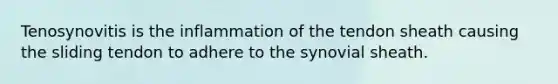 Tenosynovitis is the inflammation of the tendon sheath causing the sliding tendon to adhere to the synovial sheath.