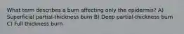 What term describes a burn affecting only the epidermis? A) Superficial partial-thickness burn B) Deep partial-thickness burn C) Full thickness burn