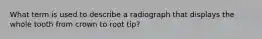 What term is used to describe a radiograph that displays the whole tooth from crown to root tip?