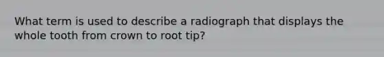 What term is used to describe a radiograph that displays the whole tooth from crown to root tip?