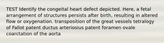 TEST Identify the congeital heart defect depicted. Here, a fetal arrangement of structures persists after birth, resulting in altered flow or oxygenation. transposition of the great vessels tetralogy of Fallot patent ductus arteriosius patent foramen ovale coarctation of the aorta