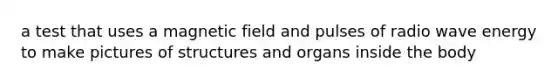 a test that uses a magnetic field and pulses of radio wave energy to make pictures of structures and organs inside the body