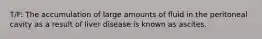 T/F: The accumulation of large amounts of fluid in the peritoneal cavity as a result of liver disease is known as ascites.