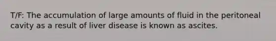 T/F: The accumulation of large amounts of fluid in the peritoneal cavity as a result of liver disease is known as ascites.