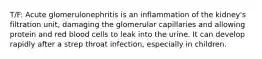 T/F: Acute glomerulonephritis is an inflammation of the kidney's filtration unit, damaging the glomerular capillaries and allowing protein and red blood cells to leak into the urine. It can develop rapidly after a strep throat infection, especially in children.