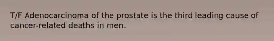 T/F Adenocarcinoma of the prostate is the third leading cause of cancer-related deaths in men.