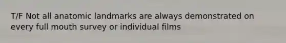 T/F Not all anatomic landmarks are always demonstrated on every full mouth survey or individual films