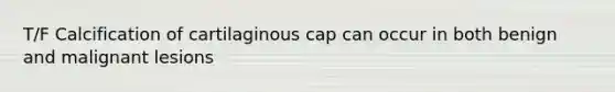 T/F Calcification of cartilaginous cap can occur in both benign and malignant lesions