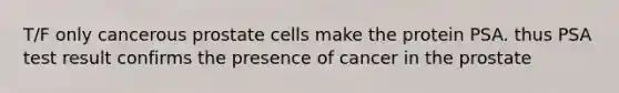 T/F only cancerous prostate cells make the protein PSA. thus PSA test result confirms the presence of cancer in the prostate