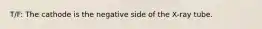 T/F: The cathode is the negative side of the X-ray tube.