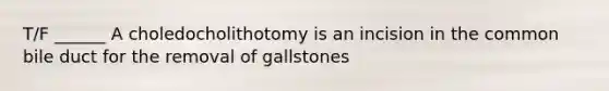 T/F ______ A choledocholithotomy is an incision in the common bile duct for the removal of gallstones