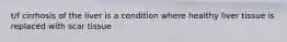 t/f cirrhosis of the liver is a condition where healthy liver tissue is replaced with scar tissue