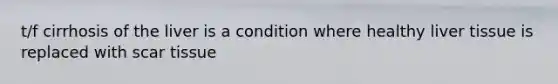 t/f cirrhosis of the liver is a condition where healthy liver tissue is replaced with scar tissue