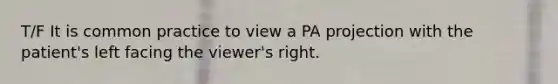 T/F It is common practice to view a PA projection with the patient's left facing the viewer's right.