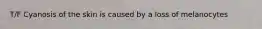 T/F Cyanosis of the skin is caused by a loss of melanocytes