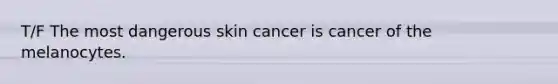 T/F The most dangerous skin cancer is cancer of the melanocytes.