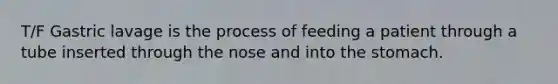 T/F Gastric lavage is the process of feeding a patient through a tube inserted through the nose and into the stomach.