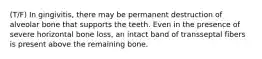 (T/F) In gingivitis, there may be permanent destruction of alveolar bone that supports the teeth. Even in the presence of severe horizontal bone loss, an intact band of transseptal fibers is present above the remaining bone.