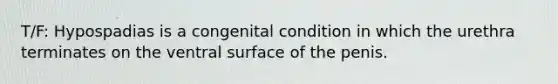 T/F: Hypospadias is a congenital condition in which the urethra terminates on the ventral surface of the penis.