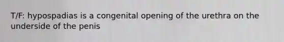 T/F: hypospadias is a congenital opening of the urethra on the underside of the penis