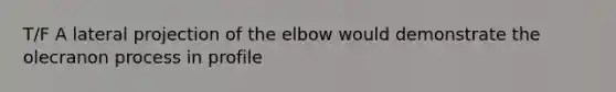 T/F A lateral projection of the elbow would demonstrate the olecranon process in profile