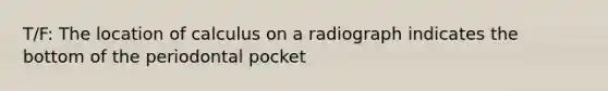 T/F: The location of calculus on a radiograph indicates the bottom of the periodontal pocket