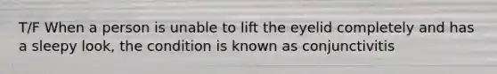 T/F When a person is unable to lift the eyelid completely and has a sleepy look, the condition is known as conjunctivitis
