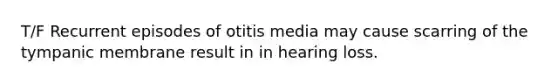 T/F Recurrent episodes of otitis media may cause scarring of the tympanic membrane result in in hearing loss.