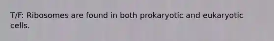 T/F: Ribosomes are found in both prokaryotic and eukaryotic cells.