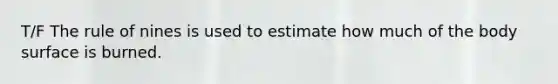 T/F The rule of nines is used to estimate how much of the body surface is burned.