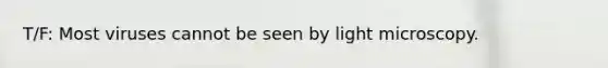 T/F: Most viruses cannot be seen by light microscopy.