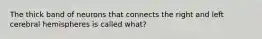 The thick band of neurons that connects the right and left cerebral hemispheres is called what?