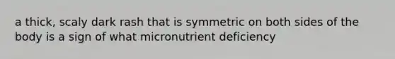 a thick, scaly dark rash that is symmetric on both sides of the body is a sign of what micronutrient deficiency