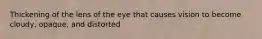 Thickening of the lens of the eye that causes vision to become cloudy, opaque, and distorted