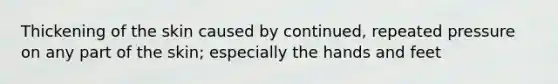 Thickening of the skin caused by continued, repeated pressure on any part of the skin; especially the hands and feet