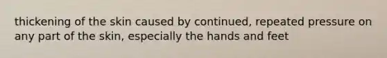 thickening of the skin caused by continued, repeated pressure on any part of the skin, especially the hands and feet