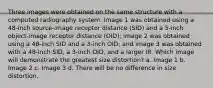 Three images were obtained on the same structure with a computed radiography system. Image 1 was obtained using a 48-inch source-image receptor distance (SID) and a 5-inch object-image receptor distance (OID); image 2 was obtained using a 48-inch SID and a 3-inch OID; and image 3 was obtained with a 48-inch SID, a 3-inch OID, and a larger IR. Which image will demonstrate the greatest size distortion? a. Image 1 b. Image 2 c. Image 3 d. There will be no difference in size distortion.