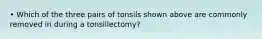 • Which of the three pairs of tonsils shown above are commonly removed in during a tonsillectomy?