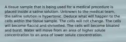 A tissue sample that is being used for a medical procedure is placed inside a saline solution. Unknown to the medical team, the saline solution is hypertonic. Deduce what will happen to the cells within the tissue sample. The cells will not change. The cells will become flaccid and shrivelled. The cells will become bloated and burst. Water will move from an area of higher solute concentration to an area of lower solute concentration.