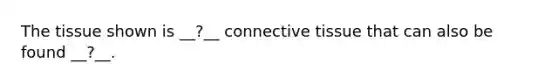 The tissue shown is __?__ connective tissue that can also be found __?__.