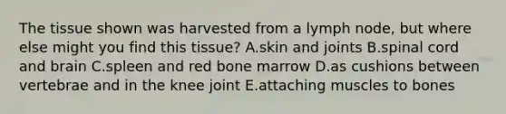 The tissue shown was harvested from a lymph node, but where else might you find this tissue? A.skin and joints B.spinal cord and brain C.spleen and red bone marrow D.as cushions between vertebrae and in the knee joint E.attaching muscles to bones