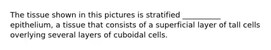 The tissue shown in this pictures is stratified __________ epithelium, a tissue that consists of a superficial layer of tall cells overlying several layers of cuboidal cells.