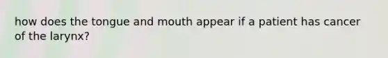 how does the tongue and mouth appear if a patient has cancer of the larynx?