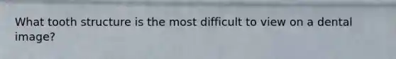 What tooth structure is the most difficult to view on a dental image?