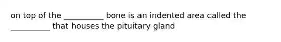 on top of the __________ bone is an indented area called the __________ that houses the pituitary gland