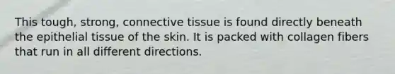 This tough, strong, connective tissue is found directly beneath the epithelial tissue of the skin. It is packed with collagen fibers that run in all different directions.